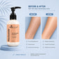 Niacinamide 10% Lotion