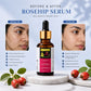 Rosehip Serum