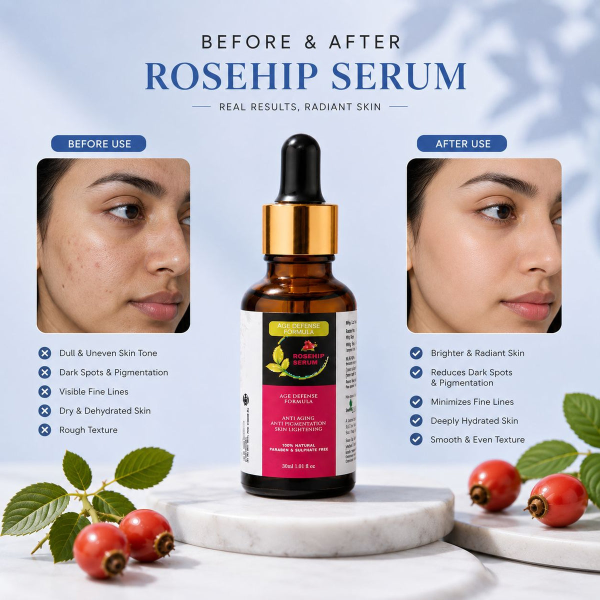 Rosehip Serum