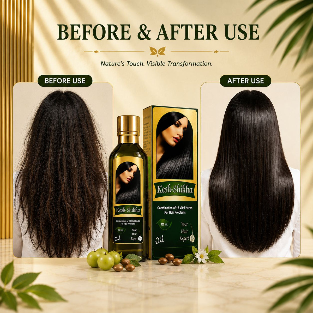 Kesh-Shikha Hair Oil