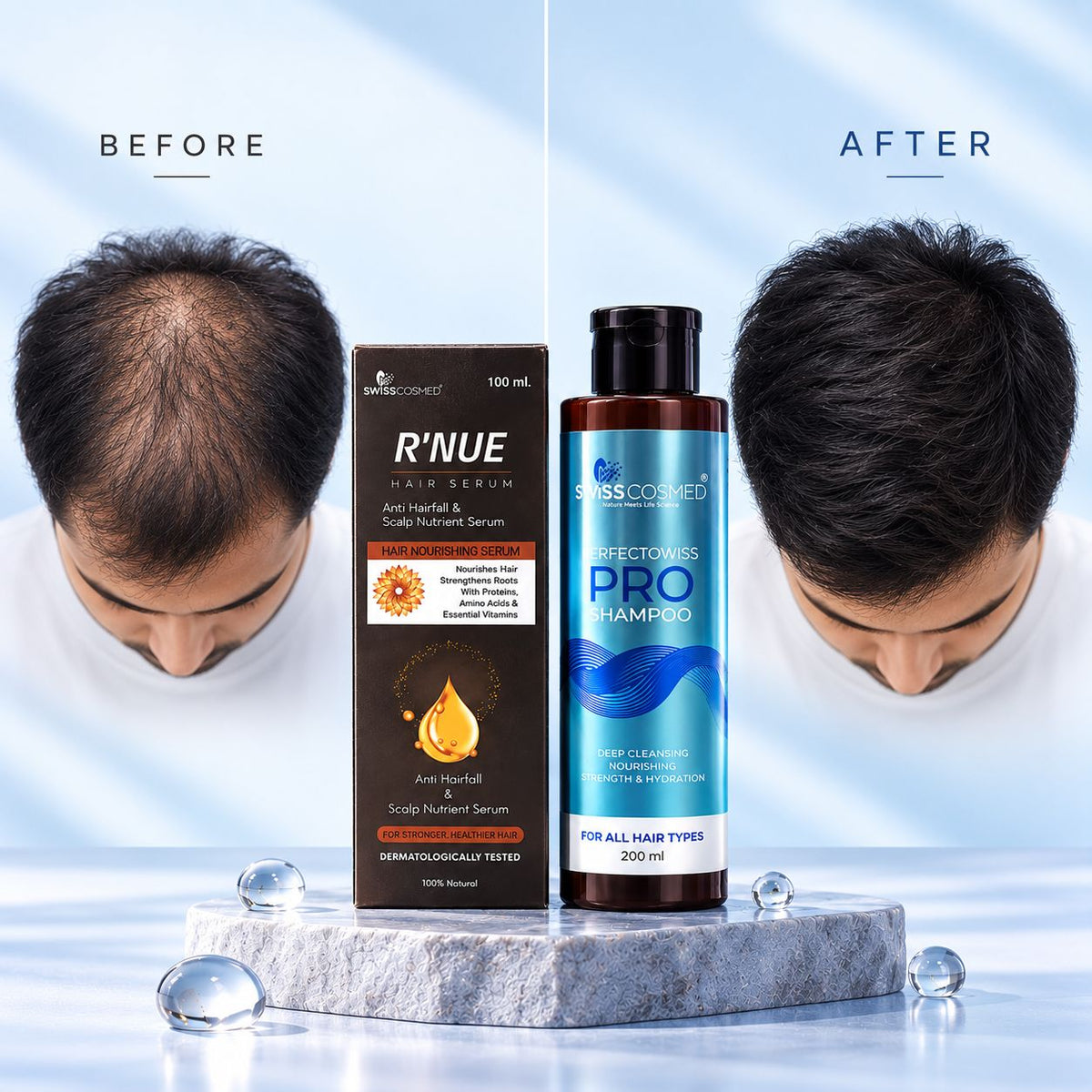 R'Nue Pro Hair Repair Duo