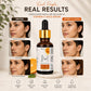 Vitamin-C Face Serum