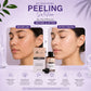 Peeling Solution