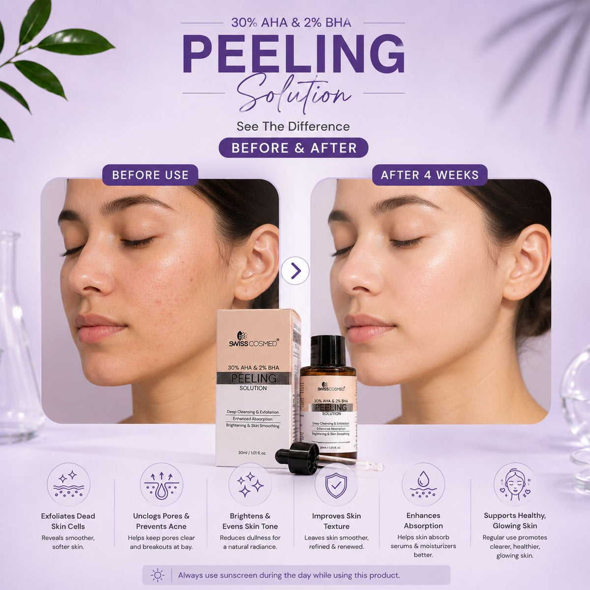 Peeling Solution