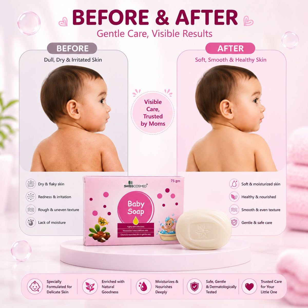 Baby Soap 75Gm