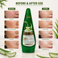 Alovera Gel