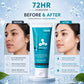 Moisturizer Cream