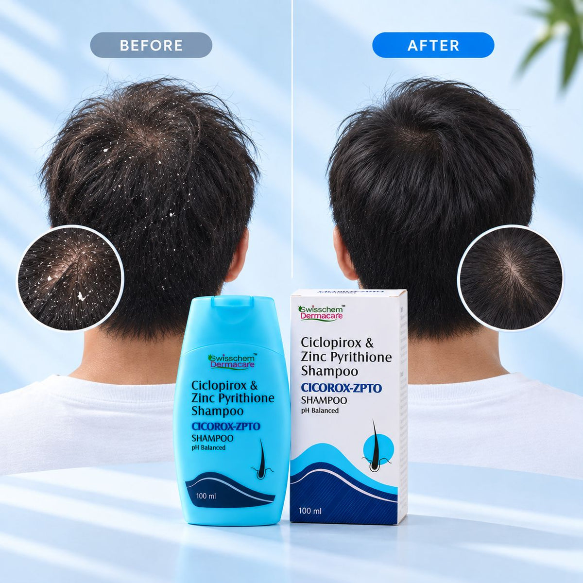 Cicorox-Zpto Shampoo